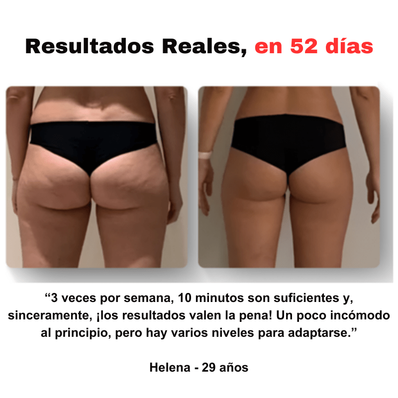 SmoothGlow™ - Masajeador anticelulítico - Dexvon