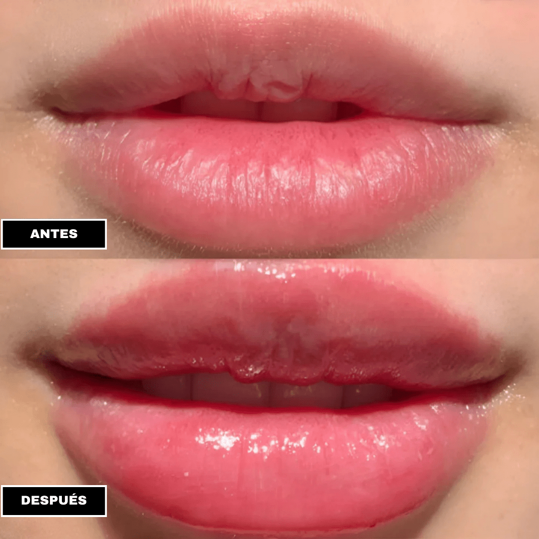 LipBoost™ - Dexvon