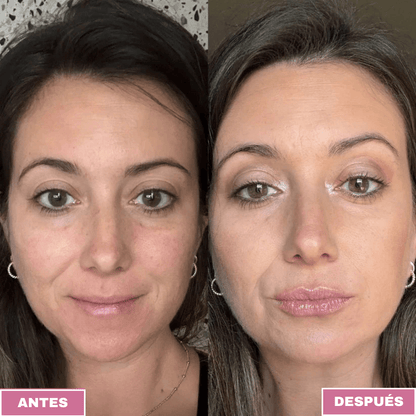 LipBoost™ - Dexvon