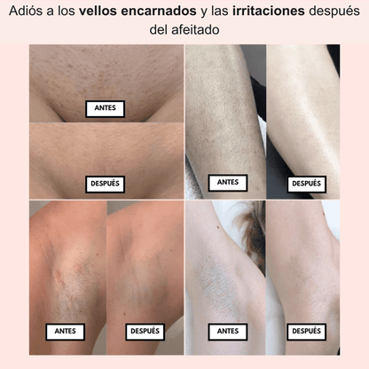 PureSkin™ – Afeitadora eléctrica para mujer - Dexvon