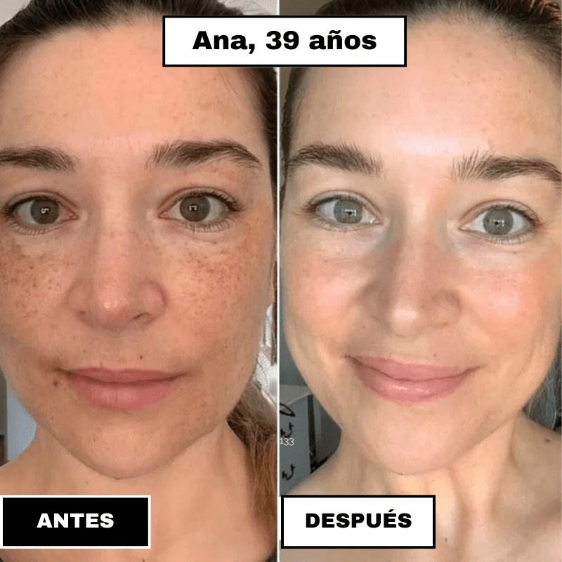 SkinElixir™ - Mascarilla de colágeno, el secreto coreano - Dexvon