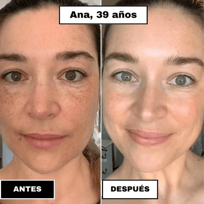 SkinElixir™ - Mascarilla de colágeno, el secreto coreano - Dexvon