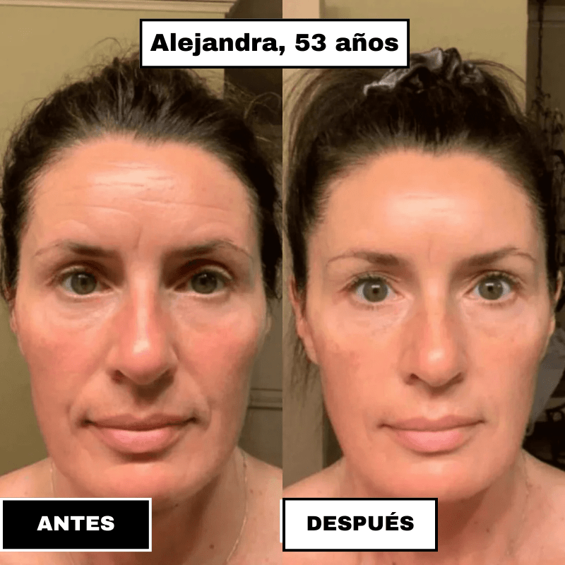 SkinElixir™ - Mascarilla de colágeno, el secreto coreano - Dexvon