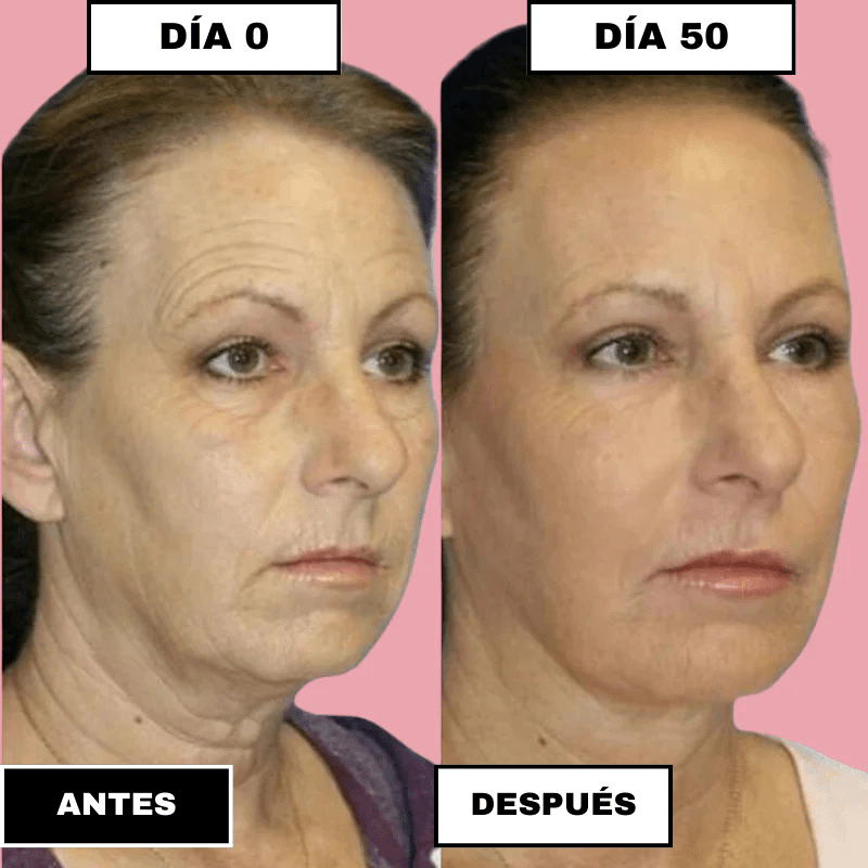 SkinElixir™ - Mascarilla de colágeno, el secreto coreano - Dexvon