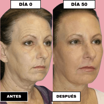 SkinElixir™ - Mascarilla de colágeno, el secreto coreano - Dexvon