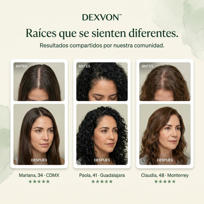 Dexvon™ – Shampoo en barra con hierbas coreanas